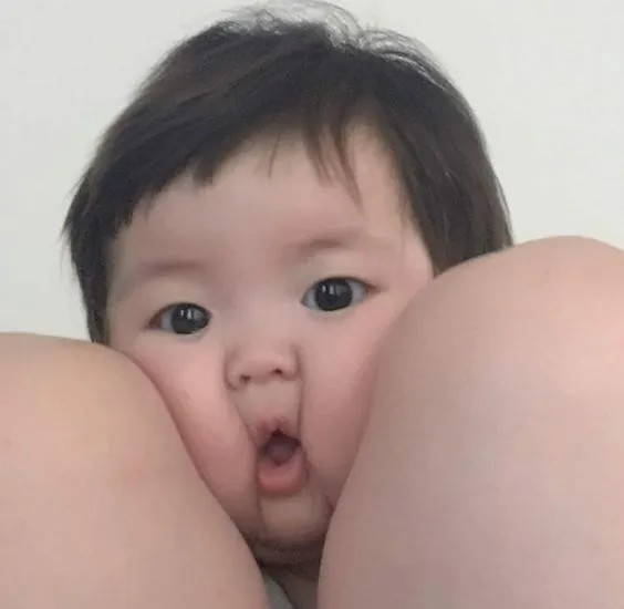 Ảnh em bé bị kẹp hai má phúng phính